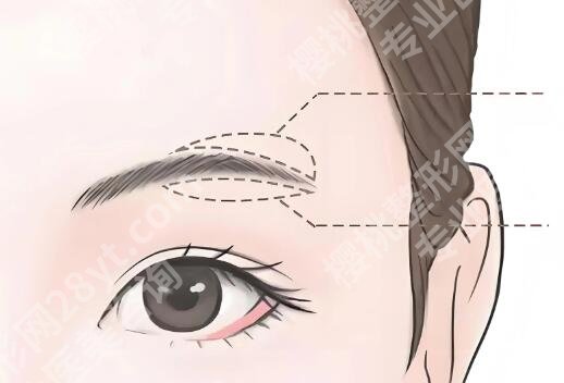 纹眉和绣眉的区别在哪里？区别太大了！别再傻傻分不清