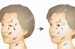 吉林省做拉皮手术医院有哪些值得关注？想做年轻化提升的人可以先了解