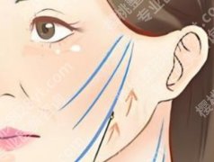 鸡西做小拉皮的医院有哪些？可选机构放在一起看，挑起来更方便