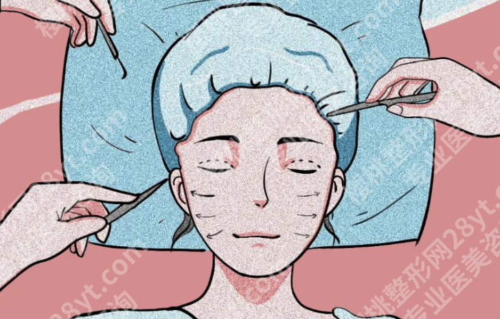 沈阳做个拉皮要多少钱？价格从哪儿拉开差距，看完心里就有数