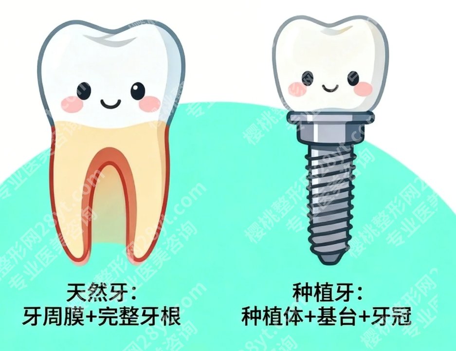 无锡种牙哪里好呢?口碑机构都帮你筛好了,缺牙党照着选