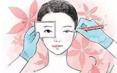 佳木斯做双眼皮排名谁排前面？别只看广告，这几个维度更关键