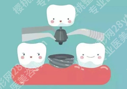 佛山种牙好的医院有哪些？热门医院名单公开、这几家很有实力！