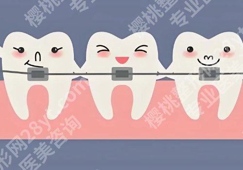 西安牙齿矫正哪家好？口碑医院排名、实用避坑攻略不花冤枉钱