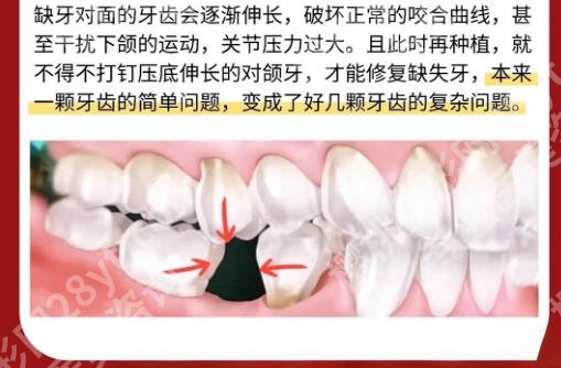 泰州哪家牙齿整形好？这5家医院技术稳、价格透闭眼选不踩坑！