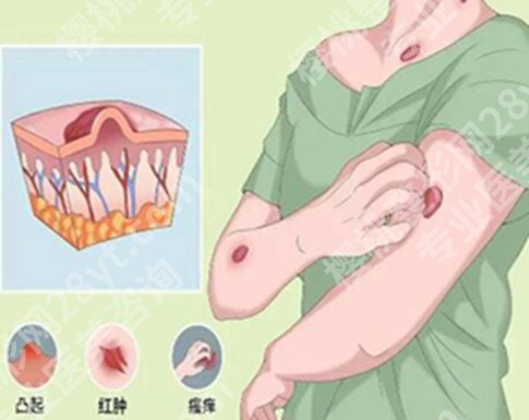 漳州去除疤痕的正规医院哪家好？top榜单医院曝光了