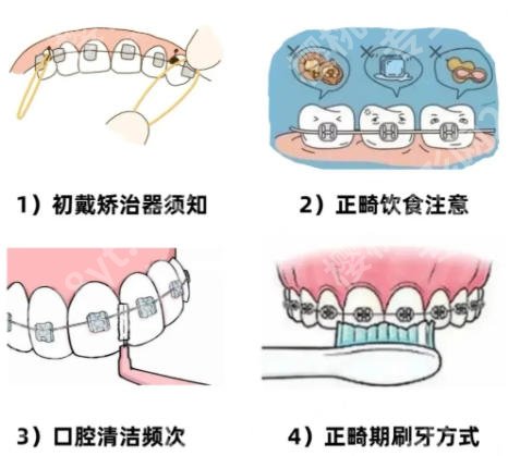 牙齿矫正南昌哪个医院好?附2026医院名单揭晓!