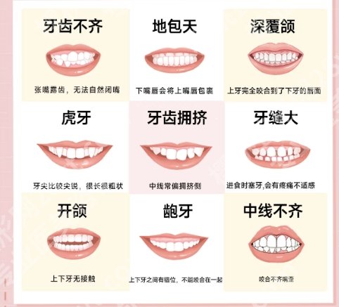 贵阳牙齿矫正哪里好?五强医院名单公布!