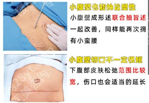 王荣锡医生怎么样？附真实网友反馈及项目推荐！