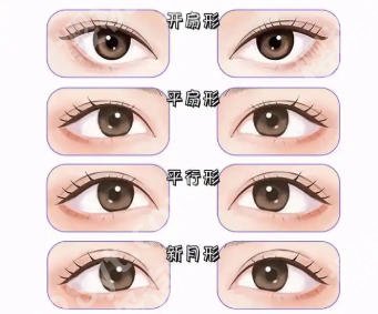 王滨福医生做眼睛怎么样？经典案例展示_见证前后蜕变！