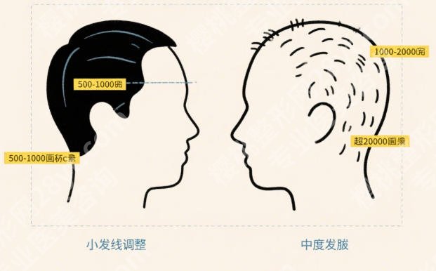 胡志奇医生厉害的三个项目盘点!审美好风格自然!