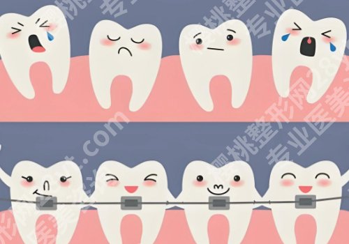 西安牙齿矫正费用一般是多少?低至10000元起,军医大口腔、西交大口腔等上榜