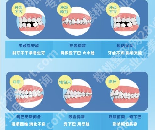烟台牙齿矫正案例图展示！毓璜顶医院、滨医烟台附院上榜！