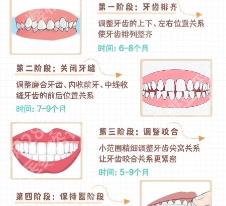 珠海牙齿矫正医生推荐名单一览！游滢滢/夏小雪上榜！