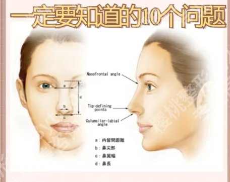 唐鏖医生做鼻子技术优势剖析！医生基本信息及擅长项目盘点！