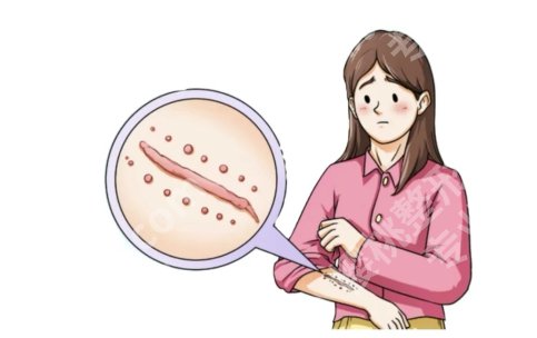 上饶有去疤医院吗？当地能做疤痕的机构整理出来了，附方案推荐