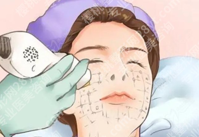 南宁点阵激光三甲医院多少钱一次?公立院真实费用出来了,附术后护理提醒