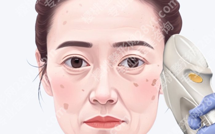遵义点阵激光医院价格表一览，各机构真实收费汇总，做之前先对比