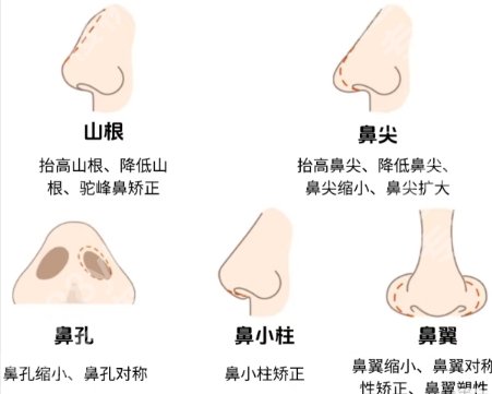 车金昊医生隆鼻怎么样?医生基本信息|隆鼻案例展示!来看效果