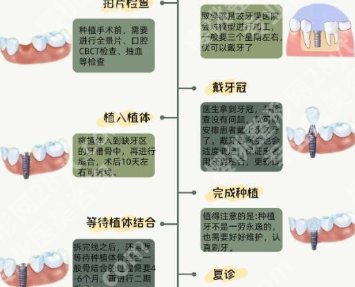 廊坊种牙几个地方可以种？公立/私立名单汇总！市人民医院位列前三