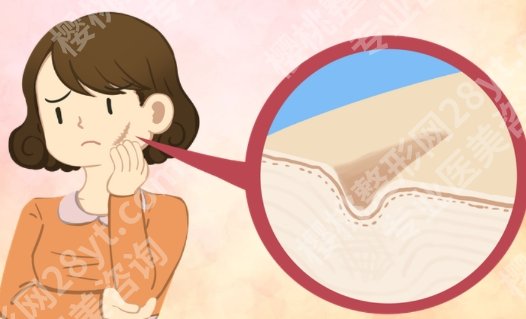莆田哪里去疤痕好？本地能做疤痕修复的正规机构整理好了，别再乱花钱
