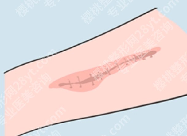 盐城祛疤痕医院哪家好?能做疤痕修复的正规机构帮你筛好了,别乱花钱