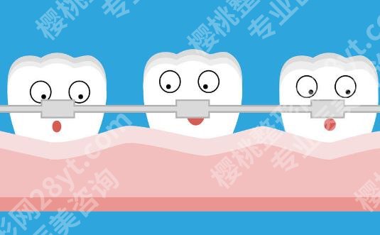 广州牙齿矫正医院排行哪家好？这份靠谱名单+干货攻略，整牙不踩坑