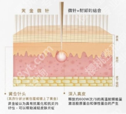 潍坊点阵激光多少钱一次?2026新价格整理,附术后护理注意事项