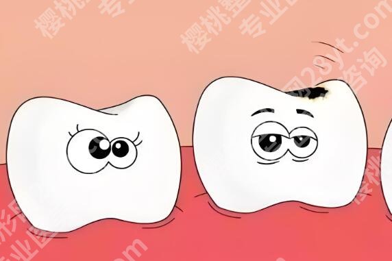 宜宾种植牙哪个医院好?曝光这几家医院排名来了