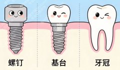 安庆种牙哪个医院比较好？人气机构大盘点，靠谱的都在这了