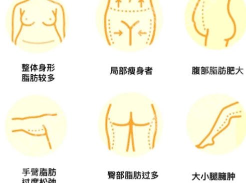车金昊吸脂技术怎么样？含技术点评及2026新价格表新鲜出炉！