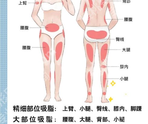 车金昊吸脂技术怎么样？含技术点评及2026新价格表新鲜出炉！