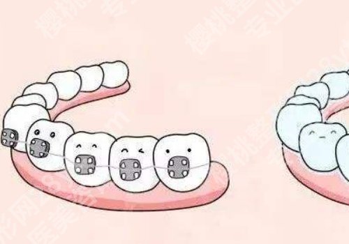 遵义牙齿矫正哪家好?2026口碑医院分享，选对，少踩坑
