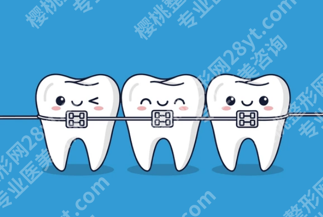 廊坊矫正牙齿多少钱？不同方式价格差不少，看完心里更有数