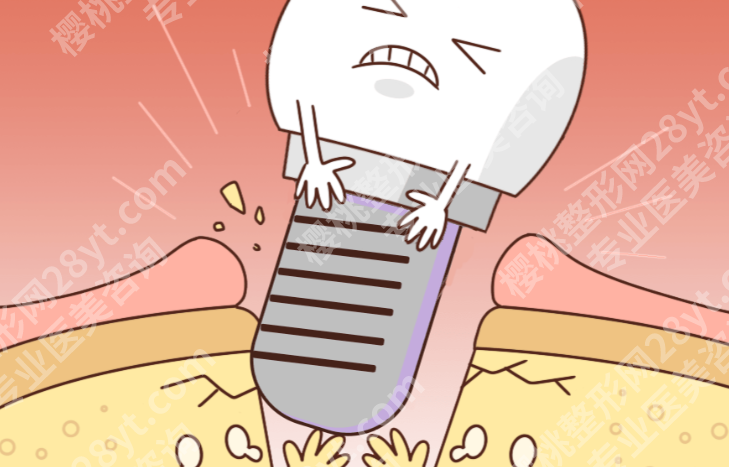 衡阳种牙多少钱一颗?单颗种植牙收费受什么影响,这篇把价格差距讲明白