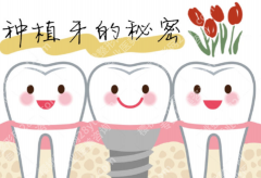 上饶全口种植牙哪家好？从面诊到术后维护，这几个方面都不能忽略