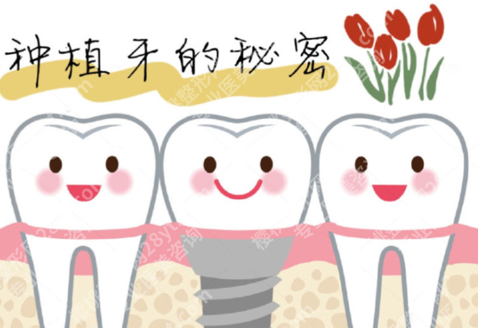上饶全口种植牙哪家好？从面诊到术后维护，这几个方面都不能忽略