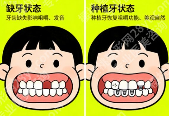 长春满口种植牙价格一览,全口各方案费用大公开,缺牙多的先看明白