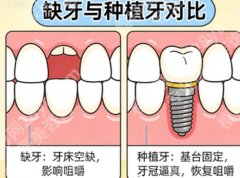 永川牙齿矫正哪里好？当地正畸靠谱机构盘点，选对医生效果差很多