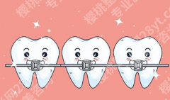 菏泽种牙多少钱一颗啊？2026新价目表，消费详情戳进来看