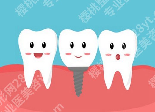 金华满口种植牙多少钱?2026新价目表+避坑指南在线分享