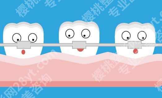 铜梁矫正牙齿大概需要多少？真实价格在线扒一扒，速存