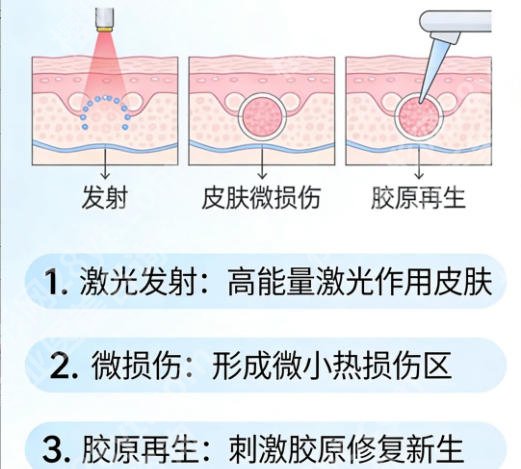 浙江点阵激光哪个医院好?专业医疗宝藏清单!