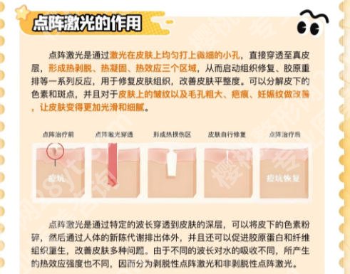 开封点阵激光哪里有？医生推荐名单来袭速速来看！