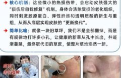 柳州人民医院点阵激光收费怎么样？热门项目激光案例展示