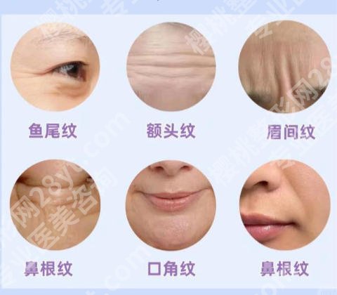 无锡除皱整形医院有哪些?这五家医院个个实力派
