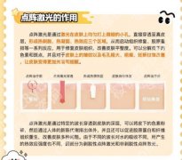 商丘点阵激光一次多少钱？费用在3k到1w不等含医院推荐及详细介绍