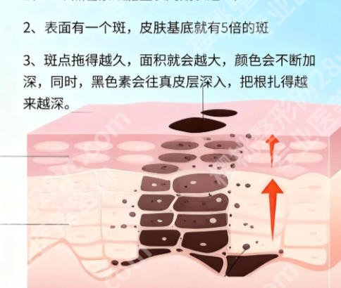 襄阳激光祛斑哪家医院好？从医院概况、医生口碑来了解