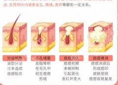 龙岩第一医院激光祛痘印费用怎么样？医院信息一览了解