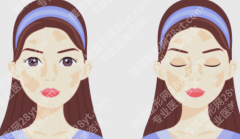 洛阳激光美容科哪家好？技术、口碑、服务全面参考
